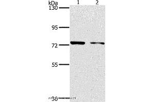 Western blot analysis of MCF7 and hela cell, using PPP1R13L Polyclonal Antibody at dilution of 1:500