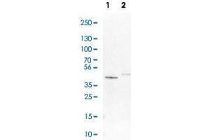 Western Blot analysis of Lane 1: NIH-3T3 cell lysate (mouse embryonic fibroblast cells) and Lane 2: NBT-II cell lysate (Wistar rat bladder tumour cells) with GALT polyclonal antibody . (GALT antibody)