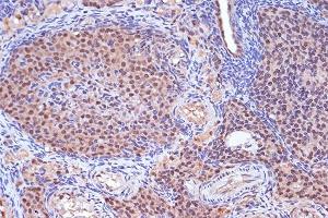 Immunohistochemistry of paraffin-embedded rat ovary using MSH2 Rabbit mAb (ABIN7268547) at dilution of 1:100 (40x lens).