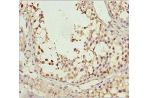 Immunohistochemistry of paraffin-embedded human testis tissue using ABIN7170649 at dilution of 1:100 (SPRED2 antibody  (AA 120-300))