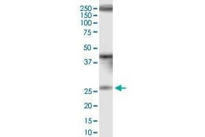 IQCF1 monoclonal antibody (M01), clone 1H4. (IQCF1 antibody  (AA 1-205))