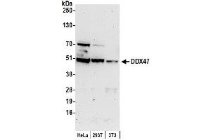 anti-DEAD (Asp-Glu-Ala-Asp) Box Polypeptide 47 (DDX47) (AA 405-455) antibody