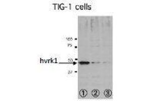 Western Blotting (WB) image for anti-Vaccinia Related Kinase 1 (VRK1) (N-Term) antibody (ABIN2452161) (VRK1 antibody  (N-Term))