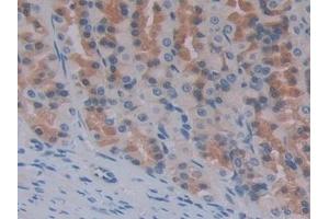 Detection of ENPEP in Rat Stomach Tissue using Polyclonal Antibody to Aminopeptidase A (ENPEP) (ENPEP antibody  (AA 409-624))