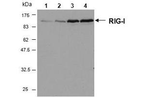 Western blot analysis of human RIG-I in HeLa cells by using RIG-I, mAb (Alme-1) . (DDX58 antibody  (AA 201-713))