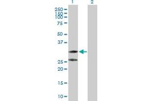 Western Blot analysis of C1QTNF2 expression in transfected 293T cell line by C1QTNF2 MaxPab polyclonal antibody. (C1QTNF2 antibody  (AA 1-285))