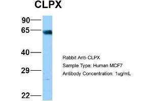 Host: Rabbit Target Name: NOP56 Sample Type: MCF7 Antibody Dilution: 1. (CLPX antibody  (C-Term))
