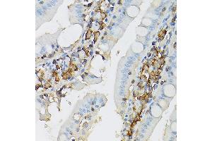 Immunohistochemistry of paraffin-embedded rat intestine using CD117/c-Kit antibody (ABIN6133454, ABIN6142896, ABIN6142898 and ABIN6213818) at dilution of 1:150 (40x lens).