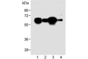 Western blot testing of human 1) HL60, 2) A431, 3) Jurkat and 4) mouse NIH3T3 cell lysate with METTL14 antibody at 1:2000. (METTL14 antibody  (AA 2-36))