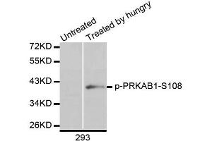 Western blot analysis of extracts of 293 cells, using Phospho-AMPKβ1-S108 antibody (ABIN5995625) at 1/1000 dilution. (PRKAB1 antibody  (pSer108))