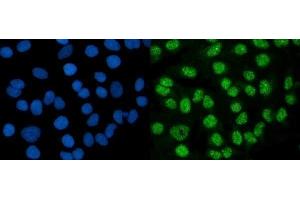 IF analysis of DMAP1 using anti-DMAP1 antibody (ABIN7601999).