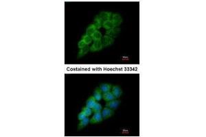ICC/IF Image Immunofluorescence analysis of methanol-fixed A431, using DARS, antibody at 1:200 dilution. (DARS antibody)
