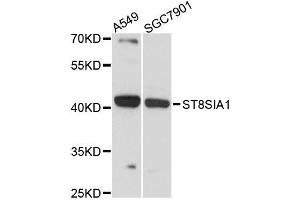 Western blot analysis of extracts of various cell lines, using ST8SIA1 antibody (ABIN5996532) at 1:3000 dilution. (ST8SIA1 antibody)