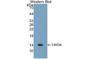 Western Blotting (WB) image for anti-Cystatin-Like 1 (CSTL1) (AA 21-114) antibody (ABIN1176755) (CSTL1 antibody  (AA 21-114))
