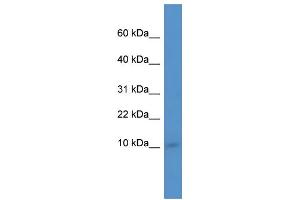 WB Suggested Anti-Ier3ip1 Antibody Titration:  0. (IER3IP1 antibody  (N-Term))