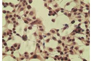 ICC staining of HeLa cell using control (rabbit Ig) at 5 ug/mL . (CYLD antibody  (AA 32-45))