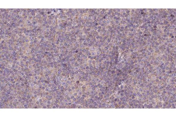 NDUFS7 antibody  (Internal Region)