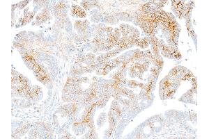 Immunohistochemistry (IHC) image for anti-Syndecan 1 (SDC1) (AA 23-251) antibody (ABIN7795742)