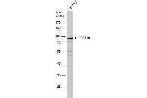 WB Image PAF49 antibody detects PAF49 protein by western blot analysis. (CD3EAP antibody  (Center))