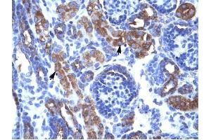 CHEK1 antibody was used for immunohistochemistry at a concentration of 4-8 ug/ml to stain Epithelial cells of renal tubule (arrows) in Human Kidney. (CHEK1 antibody)