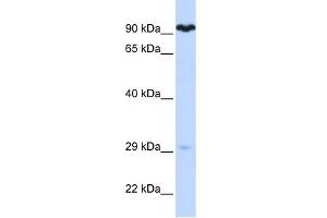WB Suggested Anti-SUPV3L1 Antibody Titration:  0. (SUPV3L1 antibody  (N-Term))