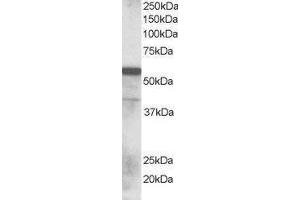 Western Blotting (WB) image for Ring Finger Protein 8 (RNF8) peptide (ABIN370148) (Ring Finger Protein 8 (RNF8) Peptide)