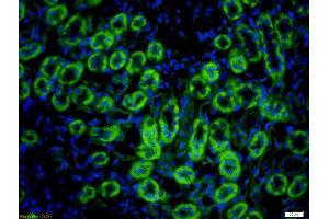 Formalin-fixed and paraffin embedded rat kidney labeled with Rabbit Anti-Hepsin Polyclonal Antibody, Unconjugated (ABIN716816) at 1:200 followed by conjugation to the secondary antibody Goat Anti-Rabbit IgG, FITC conjugated used at 1:200 dilution for 40 minutes at 37°C. (Hepsin antibody  (AA 311-417))