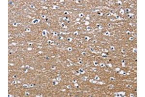 The image on the left is immunohistochemistry of paraffin-embedded Human brain tissue using ABIN7130690(PPP3CA Antibody) at dilution 1/30, on the right is treated with fusion protein. (PPP3CA antibody)
