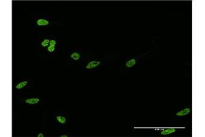 Immunofluorescence of monoclonal antibody to HOXC12 on HeLa cell. (HOXC12 antibody  (AA 1-100))