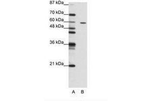 Image no. 1 for anti-Zinc Finger Protein 382 (ZNF382) (N-Term) antibody (ABIN202748)