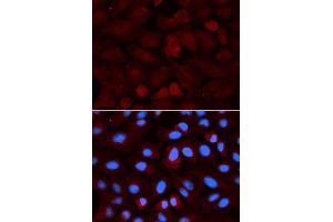 Immunofluorescence analysis of U2OS cells using ALDH3A1 antibody. (ALDH3A1 antibody  (AA 1-300))