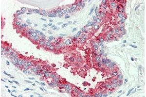 Anti-SLC12A2 / NKCC1 antibody  ABIN960804 IHC staining of human prostate. (SLC12A2 antibody  (Internal Region))