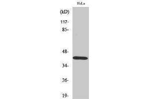 Western Blotting (WB) image for anti-serpin Peptidase Inhibitor, Clade B (Ovalbumin), Member 5 (SERPINB5) (Internal Region) antibody (ABIN3180164) (SERPINB5 antibody  (Internal Region))