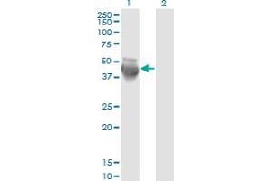 Western Blot analysis of COPS3 expression in transfected 293T cell line by COPS3 monoclonal antibody (M02A), clone 2D10. (COPS3 antibody  (AA 324-422))
