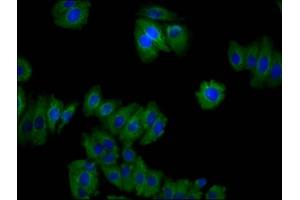 Immunofluorescence staining of HepG2 cells with ABIN7159453 at 1:100, counter-stained with DAPI. (Cyclin M2 antibody  (AA 739-875))