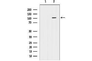 anti-Bobby Sox Homolog (BBX) (N-Term) antibody