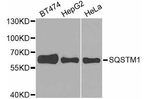 Western blot analysis of extracts of various cell lines, using SQSTM1 antibody. (SQSTM1 antibody  (AA 1-440))