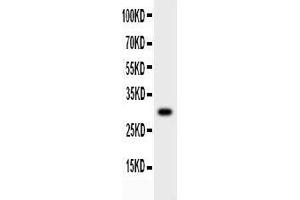 Anti-MMP7 Picoband antibody,  All lanes: Anti-MMP7 at 0.