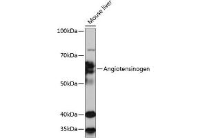 Western Blotting (WB) image for anti-Angiotensinogen (serpin Peptidase Inhibitor, Clade A, Member 8) (AGT) antibody (ABIN7265598)