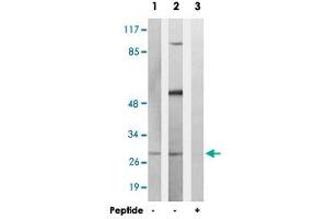 Western blot analysis of extracts from K-562 cells and COS-7 cells, using MARCH3 polyclonal antibody .