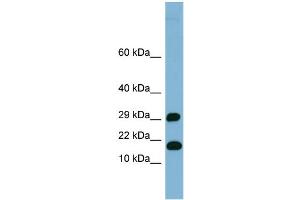 WB Suggested Anti-TRAPPC2L Antibody Titration: 0. (TRAPPC2L antibody  (N-Term))
