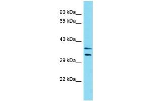 Western Blotting (WB) image for anti-Leiomodin 3 (LMOD3) (N-Term) antibody (ABIN2774556) (LMOD3 antibody  (N-Term))