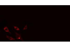 ABIN6266892 staining NIH-3T3 cells by IF/ICC. (COL13A1 antibody  (C-Term))