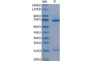 SDS-PAGE (SDS) image for Proprotein Convertase Subtilisin/kexin Type 9 (PCSK9) (AA 31-692) protein (His tag) (ABIN7275415)