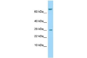 Host: Rabbit Target Name: TAS1R1 Sample Type: ACHN Whole Cell lysates Antibody Dilution: 1. (TAS1R1 antibody  (Middle Region))