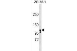 Western Blotting (WB) image for anti-La Ribonucleoprotein Domain Family, Member 1B (LARP1B) antibody (ABIN2999647) (LARP1B antibody)