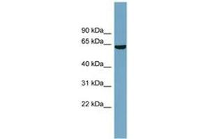 Image no. 1 for anti-Solute Carrier Family 5 (Iodide Transporter), Member 8 (SLC5A8) (AA 431-480) antibody (ABIN6743239) (SLC5A8 antibody  (AA 431-480))