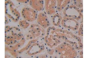 DAB staining on IHC-P; Samples: Human Kidney Tissue (TFPI antibody  (AA 29-304))