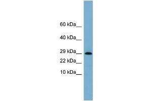 WB Suggested Anti-ERP29  Antibody Titration: 0. (ERP29 antibody  (N-Term))