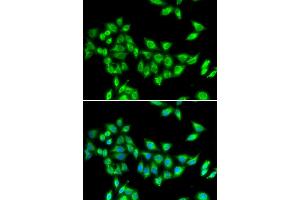 Immunofluorescence analysis of U20S cell using KIF3A antibody. (KIF3A antibody)